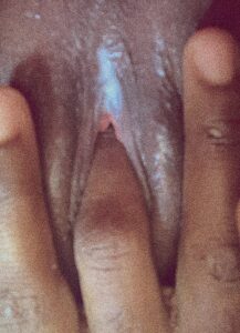 GbYXZ47W8AAIARY 217x300 1 Another 20+ Nurse Aigbedion Ivie Nude Pictures To See (Nude Photos)